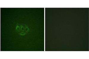 Immunofluorescence staining of methanol-fixed A549 cells using ACK1 (Phospho-Tyr284) Antibody. (TNK2 anticorps  (pTyr284))