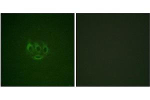 Immunofluorescence staining of methanol-fixed A549 cells using ACK1 (Phospho-Tyr284) Antibody.