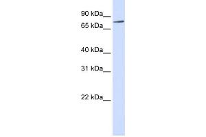 WB Suggested Anti-RIPK4 Antibody Titration:  0. (RIPK4 anticorps  (Middle Region))