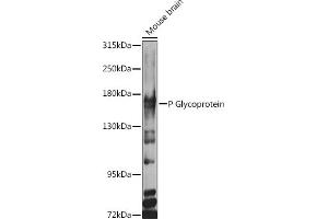 Western blot analysis of extracts of various cell lines, using P Glycoprotein antibody (ABIN6129943, ABIN6136341, ABIN6136344 and ABIN6216612) at 1:1000 dilution. (ABCB1 anticorps  (AA 630-710))