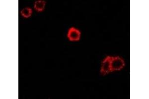 Immunofluorescent analysis of SPAM1 staining in Hela cells.