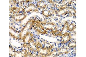 Immunohistochemistry of paraffin-embedded Mouse kidney using ZFAND3 Polyclonal Antibody at dilution of 1:100 (40x lens). (ZFAND3 anticorps)