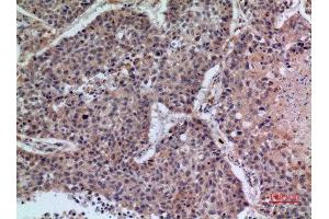 Immunohistochemistry (IHC) analysis of paraffin-embedded Human Lung, antibody was diluted at 1:100. (CD42b anticorps  (Internal Region))