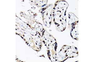 Immunohistochemistry of paraffin-embedded human placenta using A Rabbit pAb (ABIN6129868, ABIN6136479, ABIN6136480 and ABIN6221034) at dilution of 1:100 (40x lens). (BAF53A anticorps  (AA 1-280))