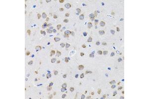 Immunohistochemistry of paraffin-embedded rat brain using IL13 antibody (ABIN5971115) (40x lens). (IL-13 anticorps)