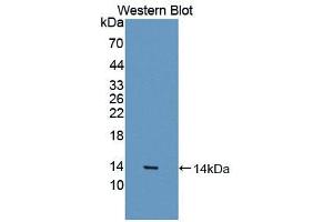 Western blot analysis of the recombinant protein. (MSTN anticorps  (AA 267-376))