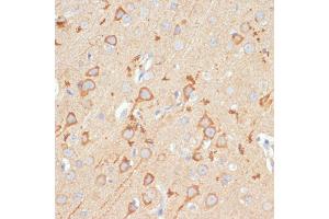 Immunohistochemistry of paraffin-embedded rat brain using GluR1/GRI Rabbit pAb (826) at dilution of 1:100 (40x lens).