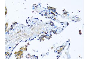 Immunohistochemistry of paraffin-embedded Human lung using MFGE8 antibody (ABIN6128291, ABIN6143792, ABIN6143794 and ABIN6215931) at dilution of 1:100 (40x lens).