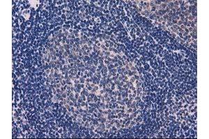 Image no. 3 for anti-Eukaryotic Translation Initiation Factor 4E Family Member 2 (EIF4E2) antibody (ABIN1497992) (EIF4E2 anticorps)