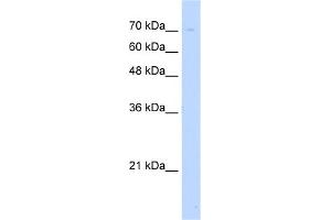 WB Suggested Anti-UNC93B1 Antibody Titration:  5. (UNC93B1 anticorps  (N-Term))