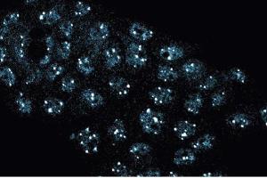 Immunofluorescence staining of A431 cells (Human epithelial carcinoma, ATCC CRL-1555). (NPAT anticorps  (AA 681-803))