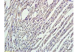 Formalin-fixed and paraffin embedded mouse myocardium labeled with (ABIN737271) Rabbit Anti-Nrf2 Polyclonal Antibody, Unconjugated 1:300 followed by conjugation to the secondary antibody and DAB staining