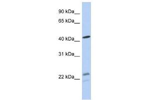 BCKDHA antibody used at 1 ug/ml to detect target protein. (BCKDHA anticorps  (N-Term))