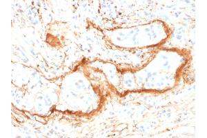 Formalin-fixed, paraffin-embedded human Small Intestine stained with Monospecific Mouse Monoclonal Antibody (ELN/1981) to Elastin. (Elastin anticorps)