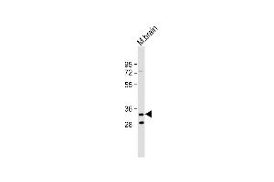Anti-TMEM106B Antibody (C-Term) at 1:2000 dilution + Mouse brain lysate Lysates/proteins at 20 μg per lane. (TMEM106B anticorps  (AA 218-252))
