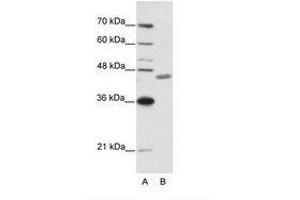 Image no. 1 for anti-Zinc Finger Protein 396 (ZNF396) (N-Term) antibody (ABIN6736192) (ZNF396 anticorps  (N-Term))