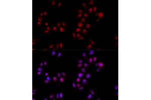 Immunofluorescence analysis of HeLa cells using HMGB1 antibody (ABIN5971378) at dilution of 1/100 (40x lens). (HMGB1 anticorps)