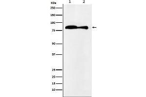 Western blot analysis of VPS35 expression in (1) HeLa cell lysate, (2) Mouse kidney lysate.