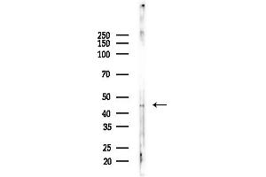 anti-Carbohydrate Sulfotransferase 10 (CHST10) (Internal Region) antibody