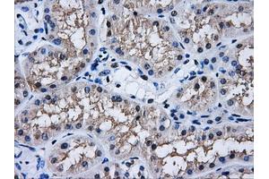 Immunohistochemistry (IHC) image for anti-Aldo-Keto Reductase Family 1, Member A1 (Aldehyde Reductase) (AKR1A1) antibody (ABIN1496542) (AKR1A1 anticorps)