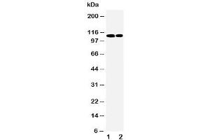 Western blot testing of p107 antibody and Lane 1:  239T (p107 anticorps  (C-Term))