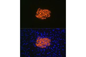 Immunofluorescence analysis of mouse pancreas using IGFBP7 Rabbit mAb (ABIN7267910) at dilution of 1:100 (40x lens). (IGFBP7 anticorps)