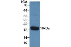 WB of Protein Standard: different control antibodies against Highly purified E. (Angiopoietin 1 Kit CLIA)