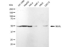 Western blotting analysis using MLKL antibody (ABIN7799480).