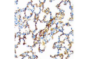 Immunohistochemistry of paraffin-embedded blood cell staining in mouse lung using Hemoglobin subunit alpha (HB) (HB) Rabbit mAb (ABIN7267608) at dilution of 1:100 (40x lens).