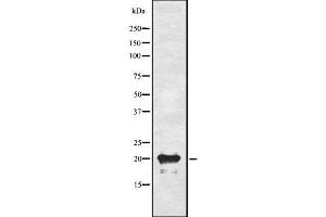 Western blot analysis of ADM using A549 whole cell lysates (Adrenomedullin anticorps  (N-Term))