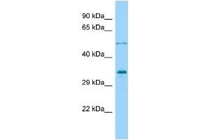 Host: Rabbit Target Name: VGLL4 Sample Type: OVCAR-3 Whole Cell lysates Antibody Dilution: 1. (VGLL4 anticorps  (Middle Region))