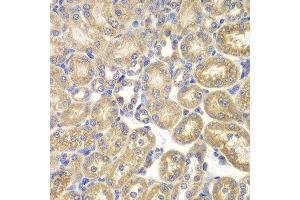 Immunohistochemistry of paraffin-embedded rat kidney using PSMD9 antibody.