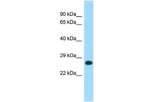 WB Suggested Anti-MOB1A Antibody Titration: 1. (MOB1A anticorps  (C-Term))