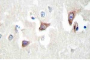 Immunohistochemistry (IHC) analyzes of MRCKbeta antibody in paraffin-embedded human brain tissue. (CDC42BPB anticorps)