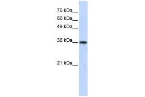 AKR7A3 antibody used at 1 ug/ml to detect target protein. (AKR7A3 anticorps)