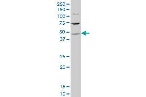 ST6GALNAC2 polyclonal antibody (A01), Lot # 060529JCS1 Western Blot analysis of ST6GALNAC2 expression in HeLa . (ST6GALNAC2 anticorps  (AA 161-270))