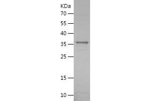 Western Blotting (WB) image for beta-1,3-Glucuronyltransferase 1 (Glucuronosyltransferase P) (B3GAT1) (AA 35-334) protein (His tag) (ABIN7121996)