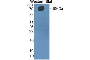 Detection of Recombinant CD5, Human using Polyclonal Antibody to Cluster Of Differentiation 5 (CD5) (CD5 anticorps  (AA 25-372))