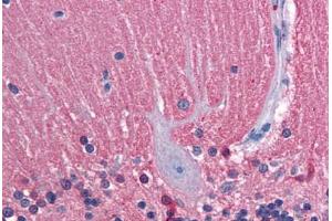 Human Brain, Cerebellum: Formalin-Fixed, Paraffin-Embedded (FFPE)