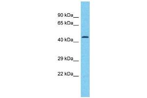 Host:  Rabbit  Target Name:  TRIM25  Sample Type:  Breast tumor lysates  Antibody Dilution:  1. (TRIM25 anticorps  (C-Term))