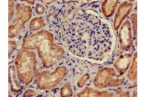 Immunohistochemistry of paraffin-embedded human kidney tissue using ABIN7146602 at dilution of 1:100