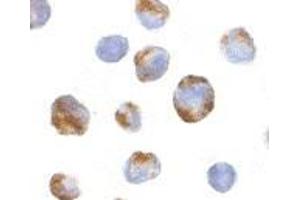 Immunocytochemistry of BMI-1 in K562 cells with AP30158PU-N BMI-1 antibody at 10 μg/ml.