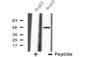 Western blot analysis of extracts from HepG2 cells using B4GALT3 antibody. (B4GALT3 anticorps  (Internal Region))