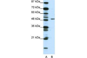 WB Suggested Anti-DPF2 Antibody Titration:  0. (DPF2 anticorps  (N-Term))