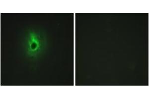 Immunofluorescence analysis of HeLa cells, using Collagen VI alpha3 Antibody. (COL6a3 anticorps  (AA 2261-2310))
