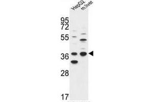 DHRS3 Antibody (Center) western blot analysis in HepG2 cell line and mouse liver tissue lysates (35µg/lane). (DHRS3 anticorps  (Middle Region))