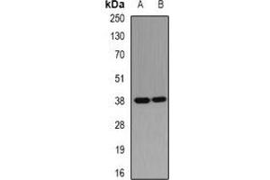 Western blot analysis of PHYH expression in MCF7 (A), HepG2 (B) whole cell lysates. (PHYH anticorps)