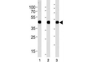 Alpha Actin antibody western blot analysis in (1) A549, (2) RD, and (3) human placenta lysate (Actin anticorps  (AA 346-375))