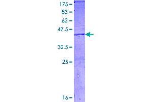 Image no. 1 for Complement Fragment C4a (C4a) (AA 61-170) protein (GST tag) (ABIN1347536)