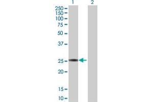 Western Blot analysis of GSTA3 expression in transfected 293T cell line by GSTA3 MaxPab polyclonal antibody. (GSTA3 anticorps  (AA 1-222))